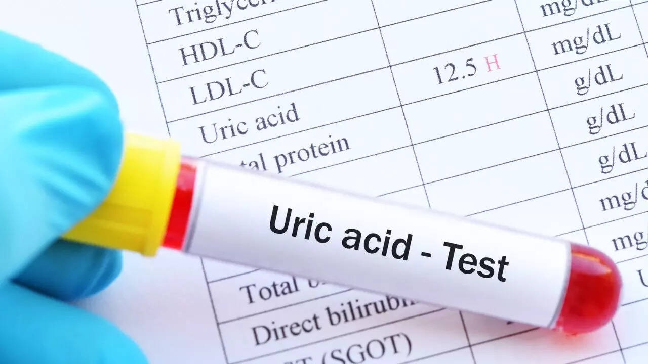 5 health conditions high uric acid can cause