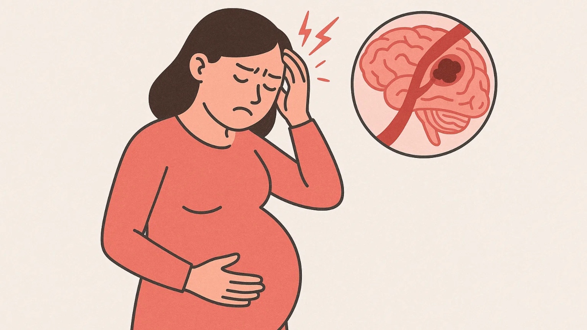 Stroke in pregnancy: Understand the causes, diagnosis, treatment and risk factors